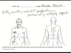 Preliminary Autopsy Michael Brown, shot with hands up or down?