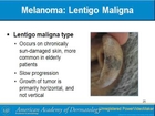Melanoma  - Basic Curicculum by American Association of Dermatology