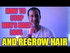 How to Stop Hair Loss And Regrow Hair - How I Now Have a Full Head of Hair!