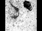 Human White Blood cells attacking a parasite.