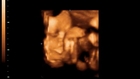 3D ultrasound Sandy,UT Lehi ultrasound imaging Studio  Sandy,UT