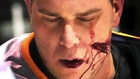 Hockey Player Injuries