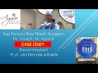 Breast Implants Tampa FL | 813-658-3600 | Aguiar Plastic Surgery | 33626 | Implant Surgery Reviews